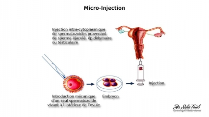 Micro-injection