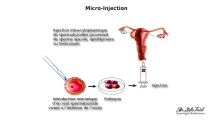 Micro-injection Micro-injection